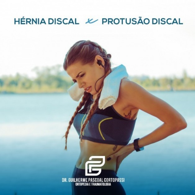 Informativo sobre Hérnia Discal x Protusão Discal