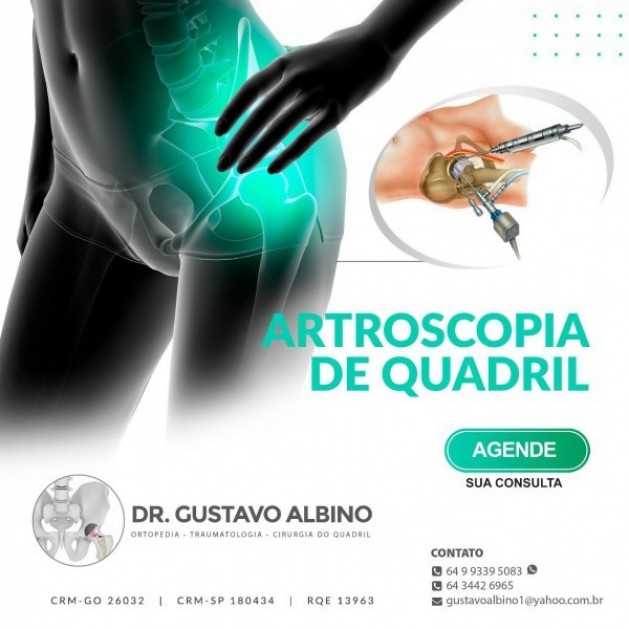 Informativo saúde: Videoartroscopia do quadril