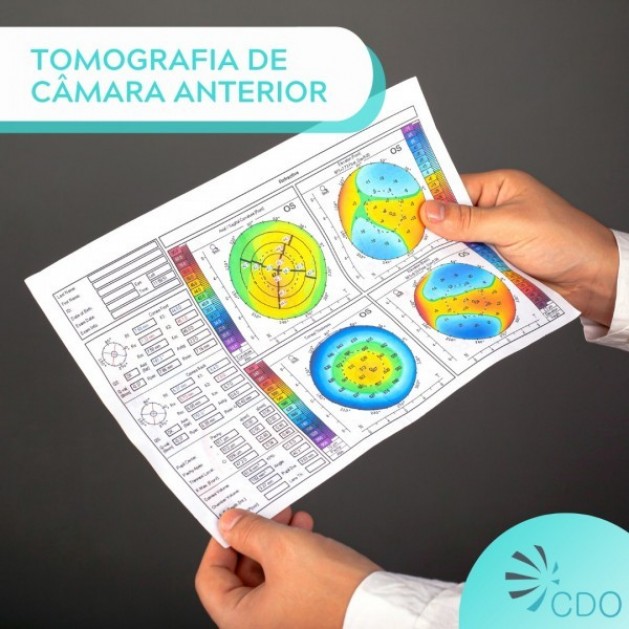 Informativo saúde com CDO - Centro de Diagnóstico em Oftalmologia